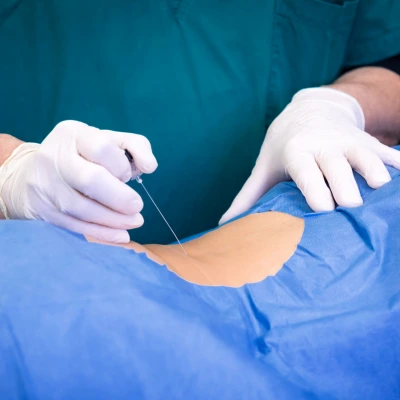 Medicina rigenerativa